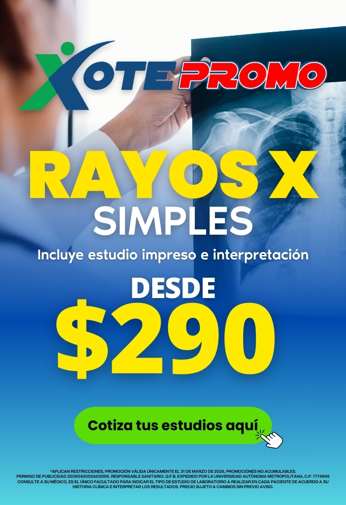 Promoción en Rayos X digitales en Ciudad de México